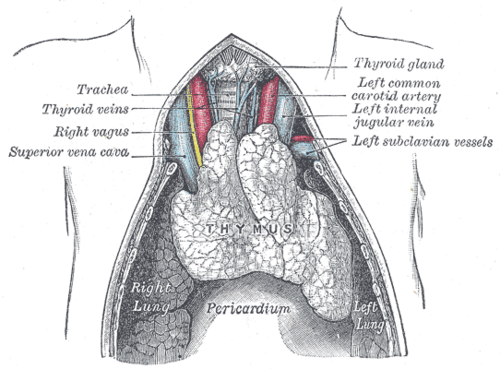 Thymus exposed in the superior and anterior mediastinum, lying on the pericardium in front of the great vessels