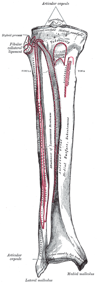 Anterior view of the right tibia and fibula with muscle attachments, the tibial tuberosity and both malleoli